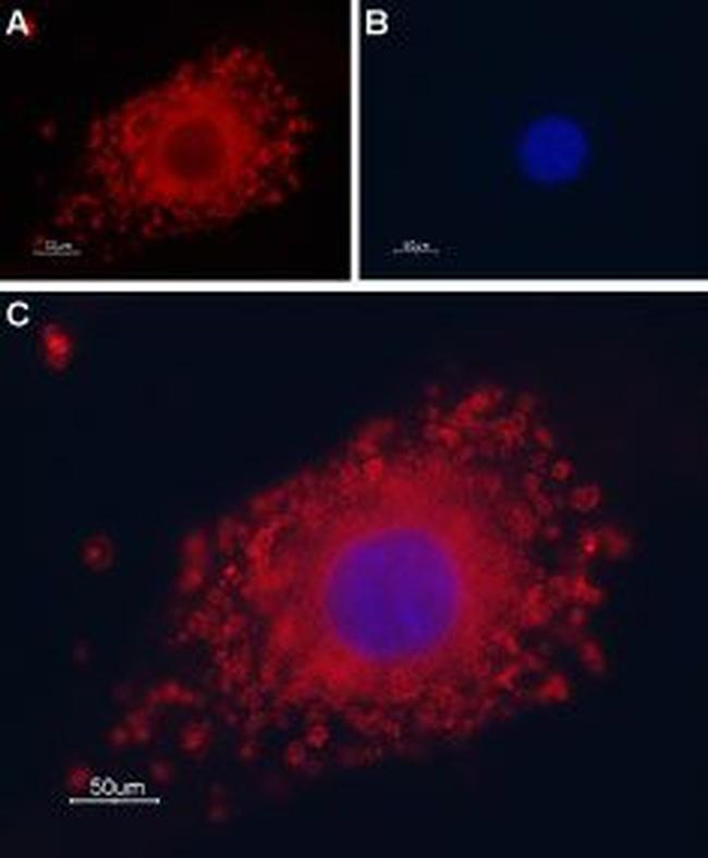 TRPP1 (PKD2) Antibody in Immunocytochemistry (ICC/IF)