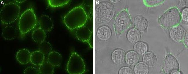 Orai1 (extracellular) Antibody in Immunocytochemistry (ICC/IF)