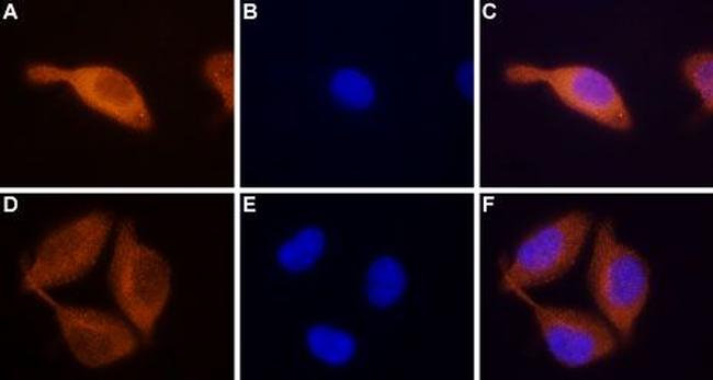 STIM2 Antibody in Immunocytochemistry (ICC/IF)