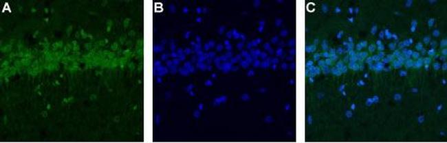 CALHM1 Antibody in Immunohistochemistry (IHC)