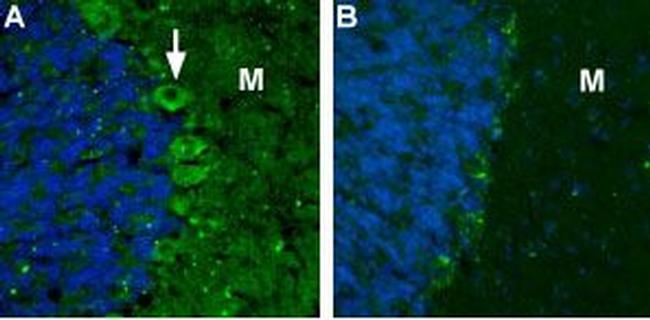 CACNA2D2 (CaV alpha 2 delta 2) (extracellular) Antibody in Immunohistochemistry (IHC)