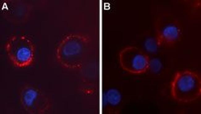 CACNA2D4 (CaV alpha 2 delta 4) (extracellular) Antibody in Immunocytochemistry (ICC/IF)