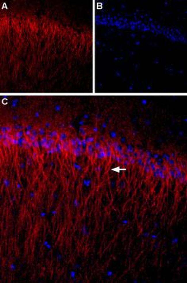 CACNB1 Antibody in Immunohistochemistry (IHC)