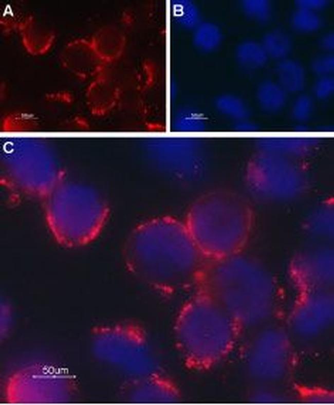 TRPC6 (extracellular) Antibody in Immunocytochemistry (ICC/IF)