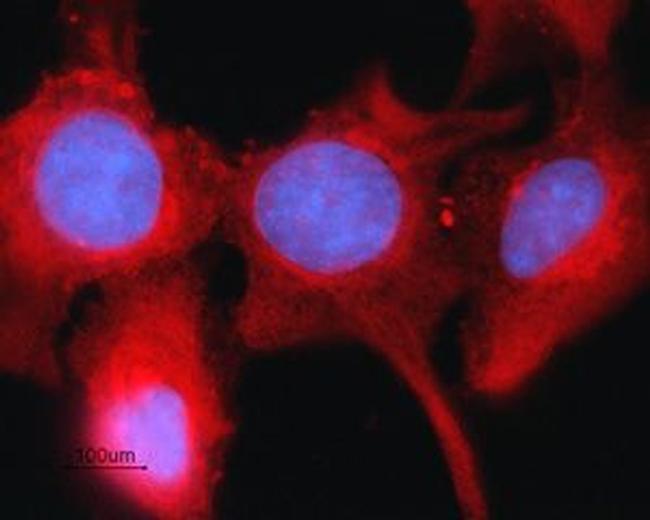 Connexin-43 Antibody in Immunocytochemistry (ICC/IF)