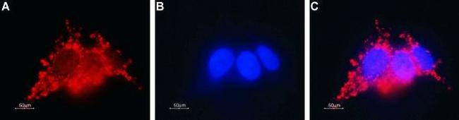 Connexin-26 (GJB2) Antibody in Immunocytochemistry (ICC/IF)