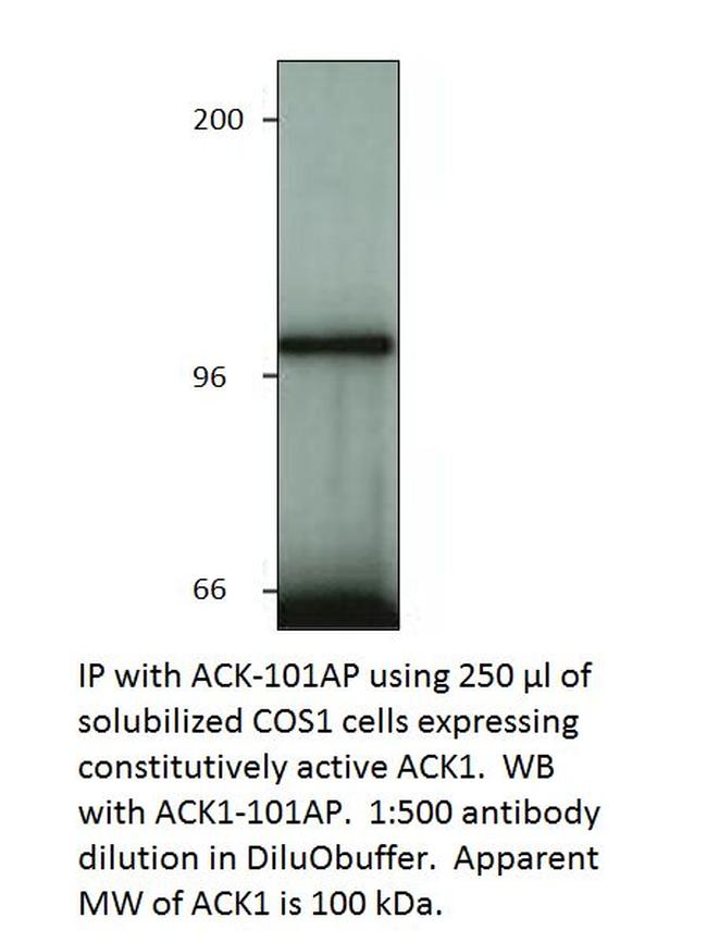 ACK1 Antibody in Western Blot (WB)