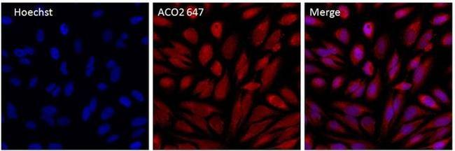 Aconitase 2 Antibody in Immunocytochemistry (ICC/IF)