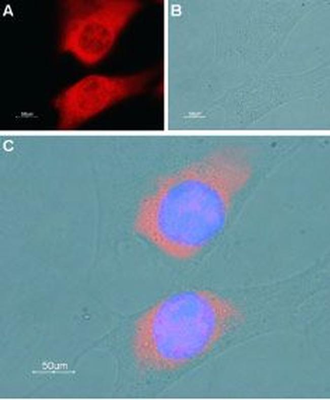 SERCA1 Antibody in Immunocytochemistry (ICC/IF)