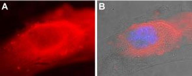 SERCA2 Antibody in Immunocytochemistry (ICC/IF)