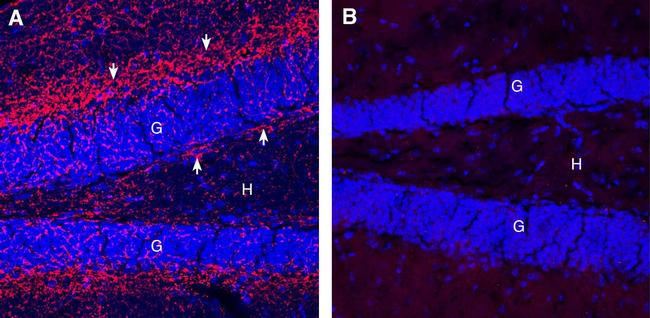 Cannabinoid Receptor 1 (extracellular) Antibody in Immunohistochemistry (Frozen) (IHC (F))