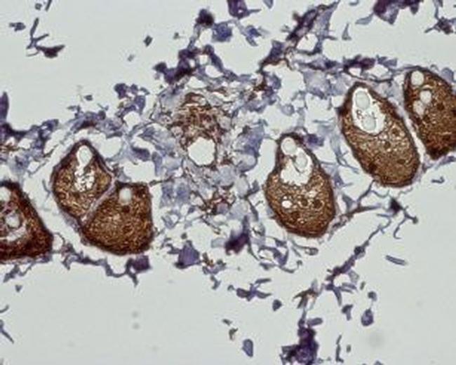 Cannabinoid Receptor 2 Antibody in Immunohistochemistry (Paraffin) (IHC (P))