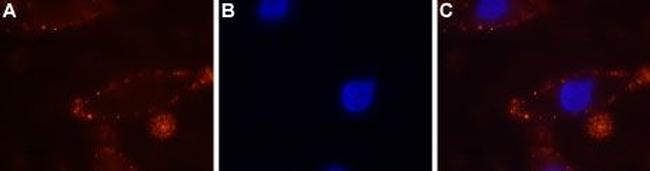 Calcium Sensing Receptor (extracellular) Antibody in Immunocytochemistry (ICC/IF)