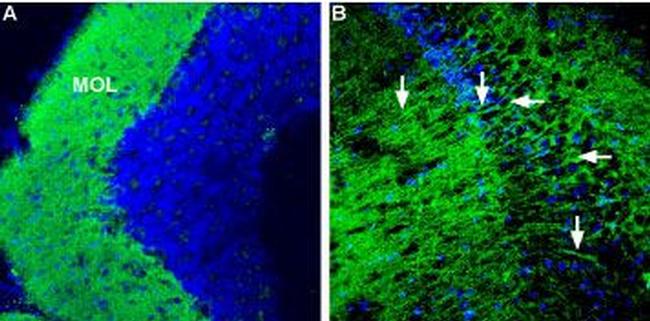 CRF1/CRHR1 (extracellular) Antibody in Immunohistochemistry (IHC)