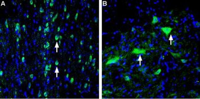 Vesicular Acetylcholine Transporter (VAChT) Antibody in Immunohistochemistry (Frozen) (IHC (F))