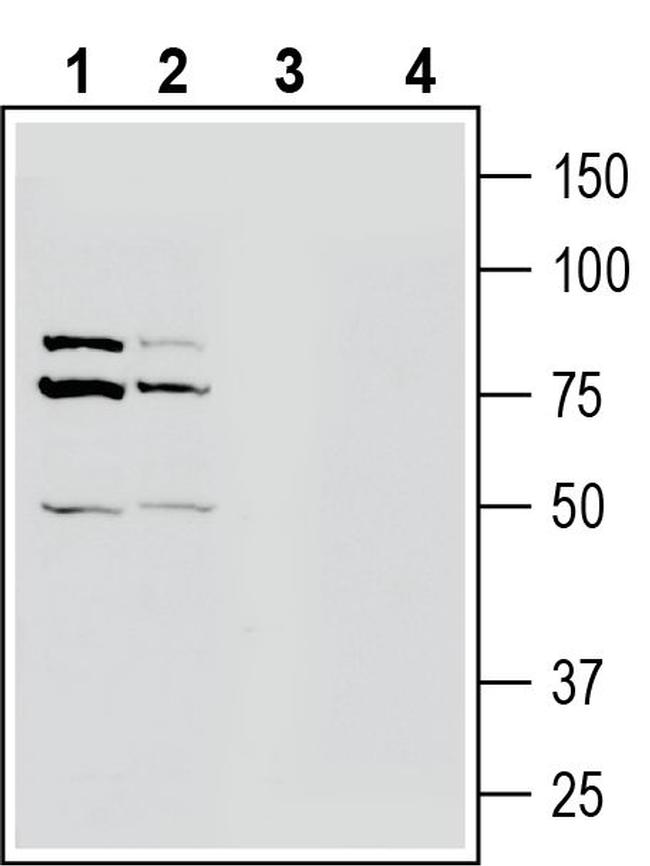 OCTN1/SLC22A4 Antibody in Western Blot (WB)