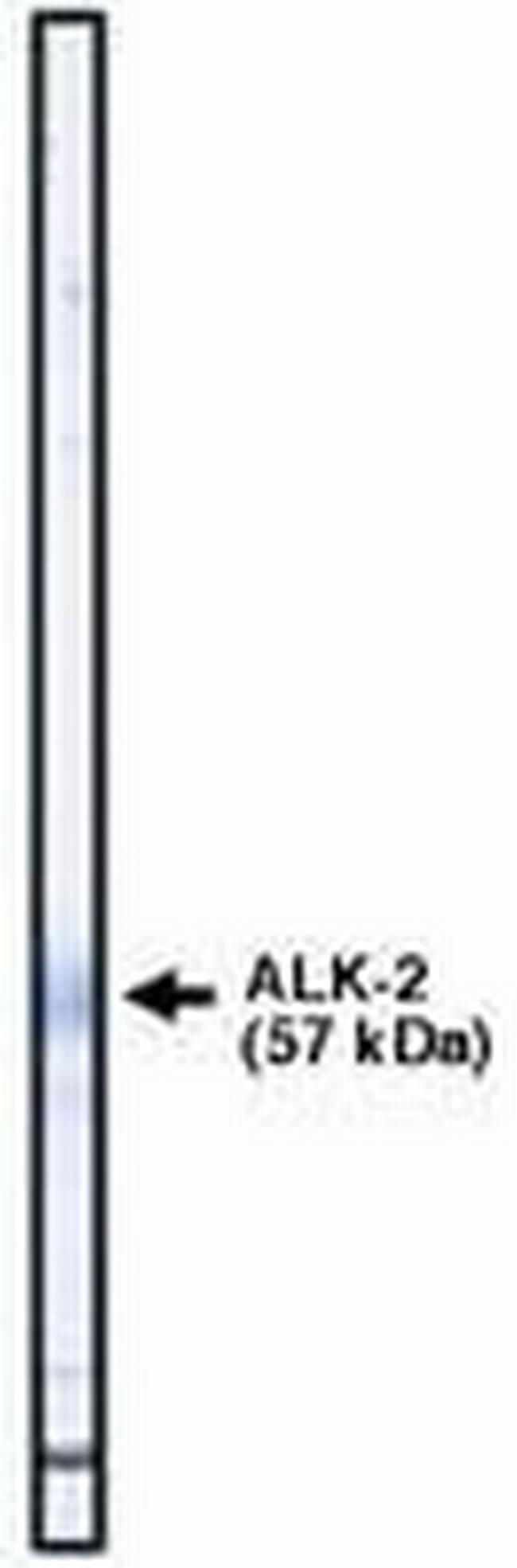 ACVR1 Antibody in Western Blot (WB)