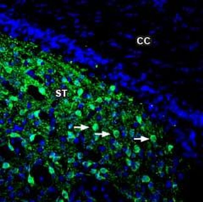 DARPP32 Antibody in Immunohistochemistry (Frozen) (IHC (F))