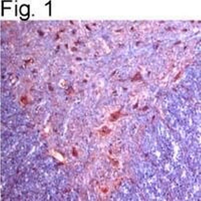 alpha-2c Adrenergic Receptor Antibody in Immunohistochemistry (IHC)