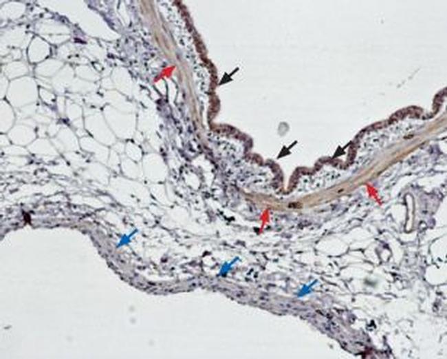 Endothelin Receptor B Antibody in Immunohistochemistry (Paraffin) (IHC (P))