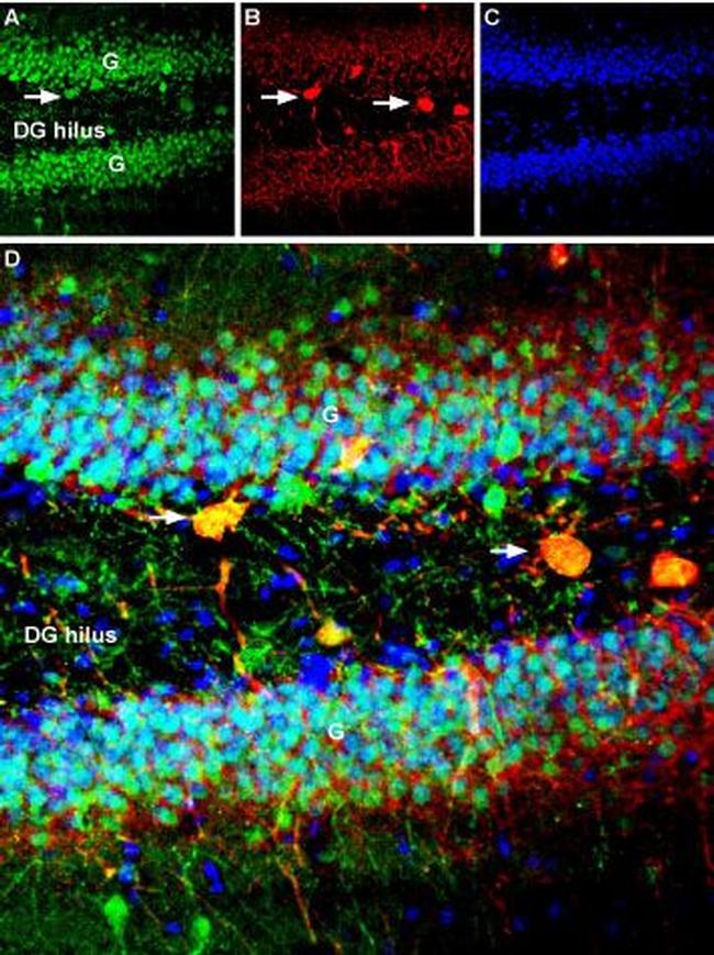 GPER (GPR30) Antibody in Immunohistochemistry (IHC)