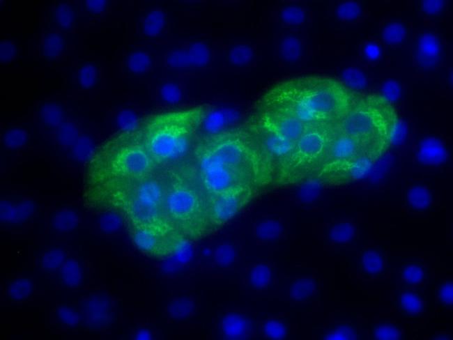 AFP Antibody in Immunocytochemistry (ICC/IF)