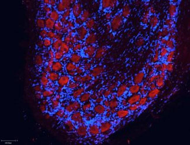 NMDAR2B (GluN2B) (extracellular) Antibody in Immunohistochemistry (Frozen) (IHC (F))