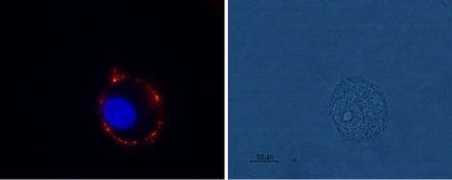 mGluR1 (extracellular) Antibody in Immunocytochemistry (ICC/IF)