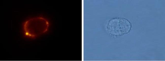 mGluR5 (extracellular) Antibody in Immunocytochemistry (ICC/IF)