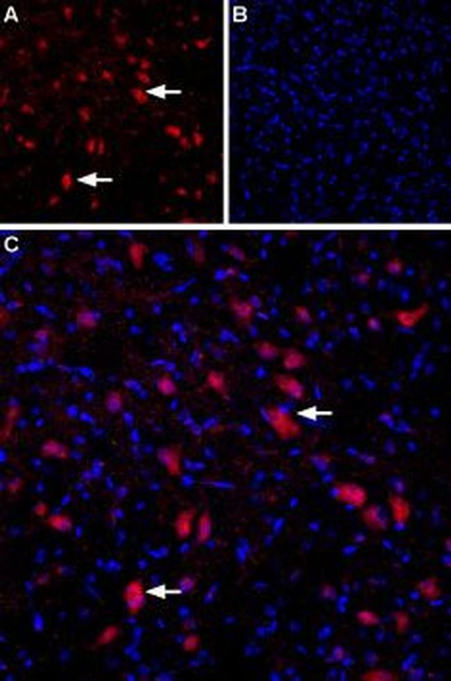 GRIK4 (KA1) (extracellular) Antibody in Immunohistochemistry (Frozen) (IHC (F))