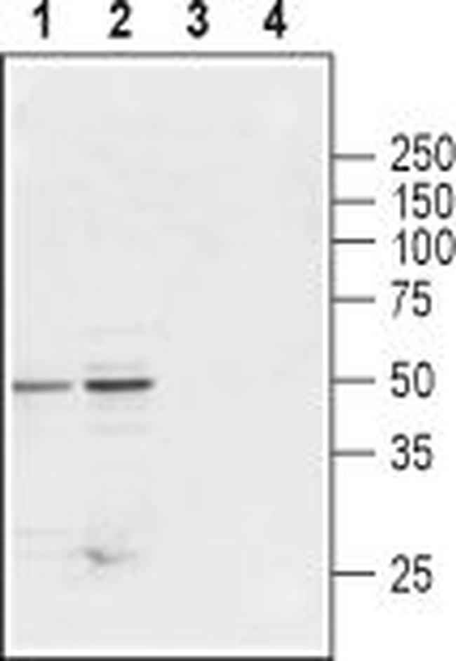 Glycine Receptor beta Antibody in Western Blot (WB)