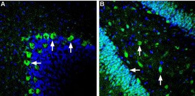 GLUT2 (SLC2A2) Antibody in Immunohistochemistry (Frozen) (IHC (F))