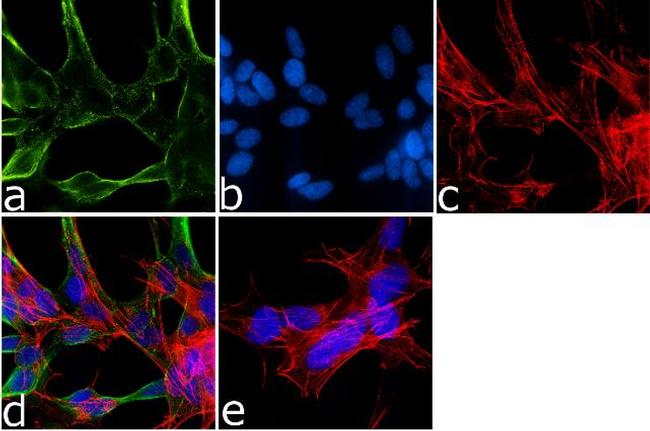 alpha Synuclein Antibody in Immunocytochemistry (ICC/IF)