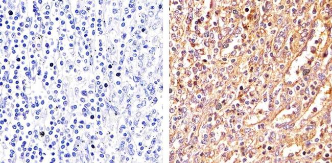 IL-6 Antibody in Immunohistochemistry (Paraffin) (IHC (P))