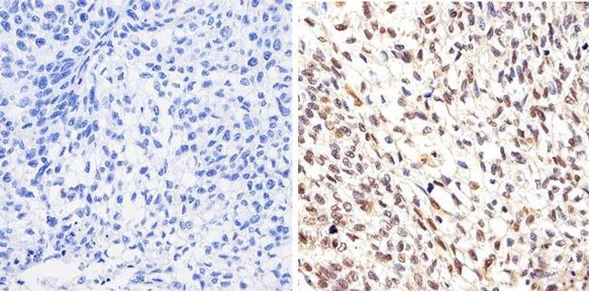 AKT1 Antibody in Immunohistochemistry (Paraffin) (IHC (P))