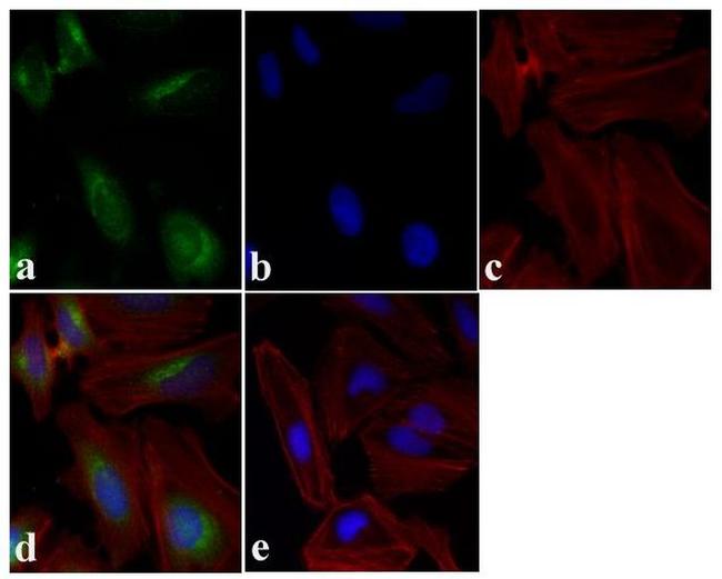 mTOR Antibody in Immunocytochemistry (ICC/IF)