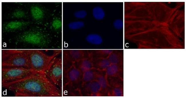 FAK Antibody in Immunocytochemistry (ICC/IF)