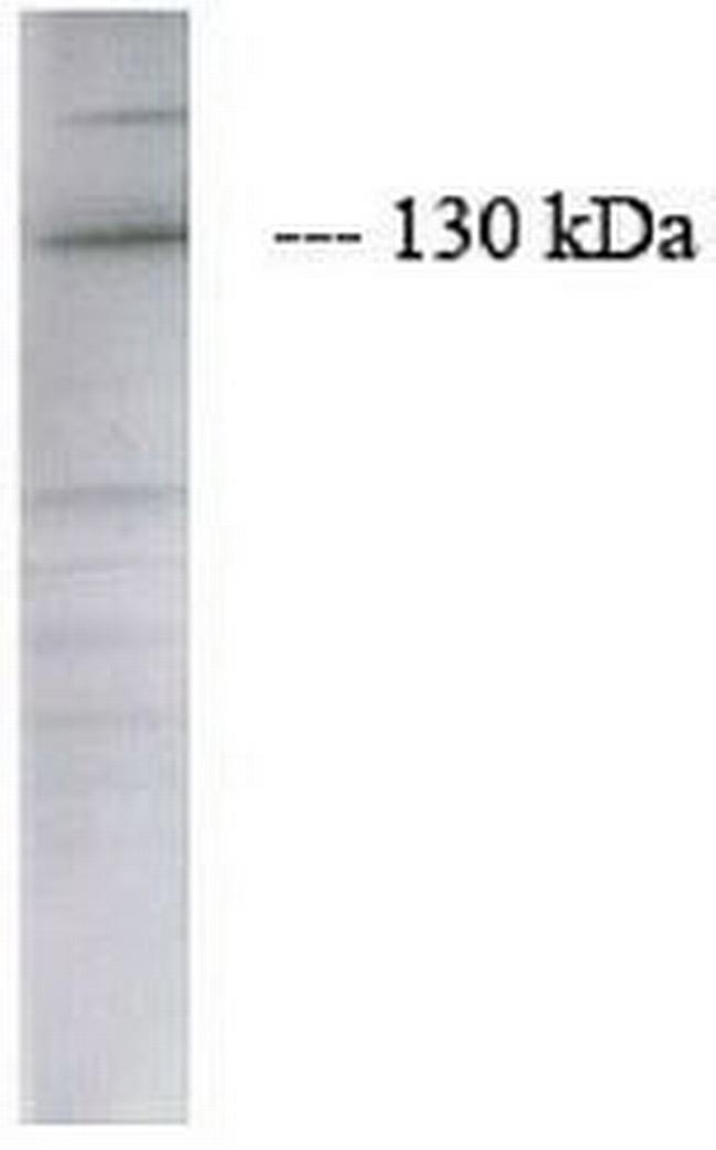 JAK2 Antibody in Western Blot (WB)