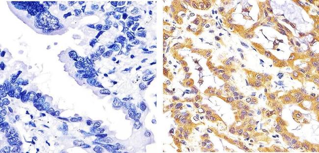 JNK1/JNK2 Antibody in Immunohistochemistry (Paraffin) (IHC (P))