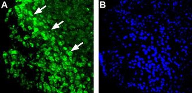 Histamine H1 Receptor (HRH1) Antibody in Immunohistochemistry (IHC)