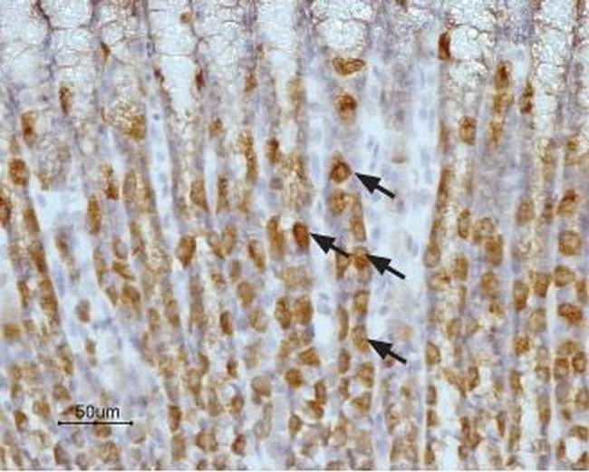 Histamine H2 Receptor (HRH2) (extracellular) Antibody in Immunohistochemistry (Paraffin) (IHC (P))