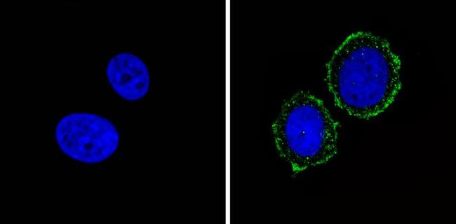 INSR alpha Antibody in Immunocytochemistry (ICC/IF)