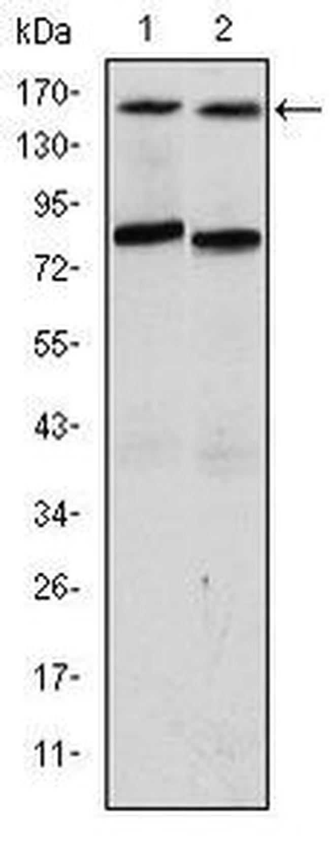 AIB1 Antibody in Western Blot (WB)