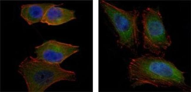 AKT2 Antibody in Immunocytochemistry (ICC/IF)