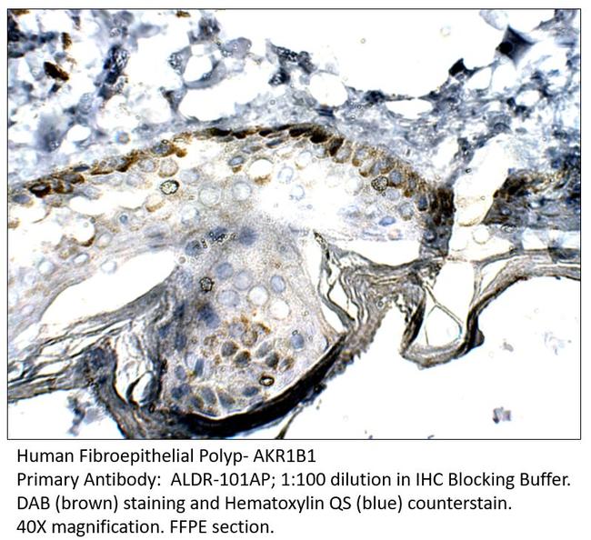 AKR1B1 Antibody in Immunohistochemistry (Paraffin) (IHC (P))