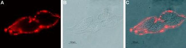 KCNN4 (KCa3.1, SK4) (extracellular) Antibody in Immunocytochemistry (ICC/IF)