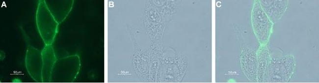 KCNN4 (KCa3.1, SK4) (extracellular) Antibody in Immunocytochemistry (ICC/IF)