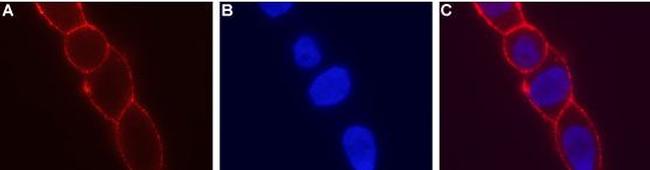 KCNN4 (KCa3.1, SK4) (extracellular) Antibody in Immunocytochemistry (ICC/IF)