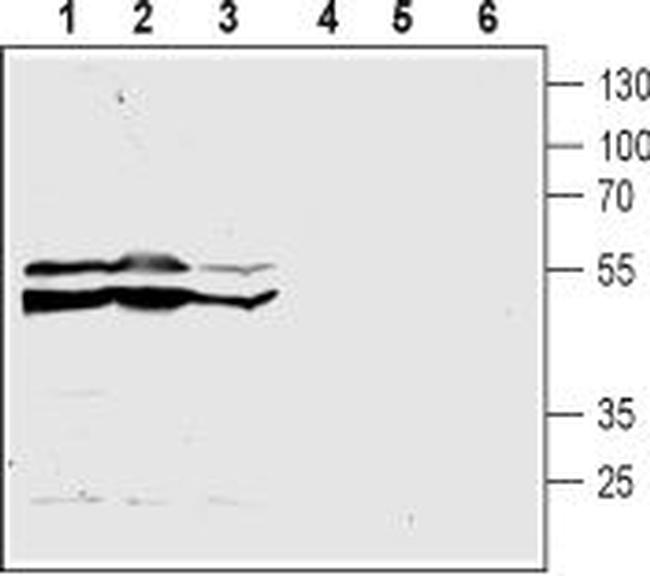 CysLTR2 (extracellular) Antibody in Western Blot (WB)