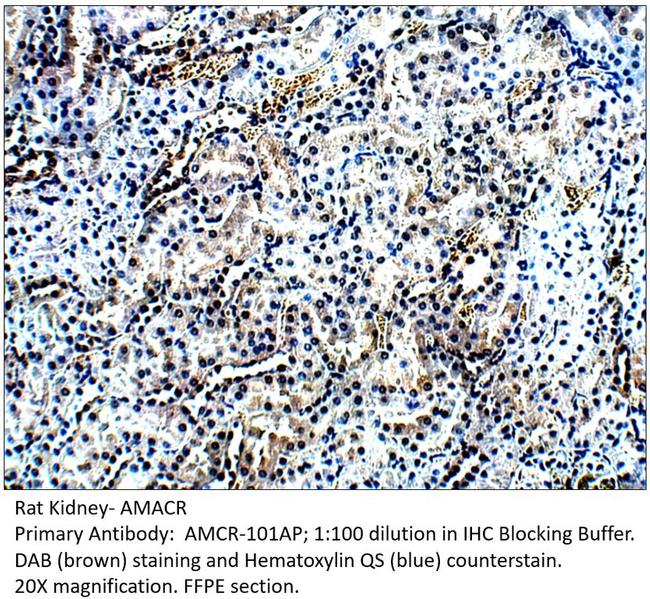 AMACR Antibody in Immunohistochemistry (IHC)